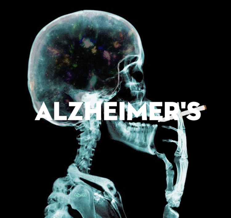 Alzheimer's